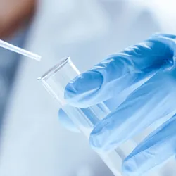 Microbiological research with a test tube and micropipette in hands of a laboratory worker in close-up