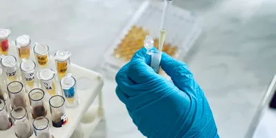 Close-up of an ELISA microplate used in immunological testing, representing assay-based biomarker discovery techniques in laboratory diagnostics.
