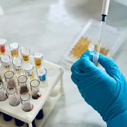 Close-up of an ELISA microplate used in immunological testing, representing assay-based biomarker discovery techniques in laboratory diagnostics.