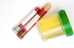 Sterile urine sample container and blood test tube representing biological matrices commonly used in forensic and clinical toxicology research with HF-LPME.