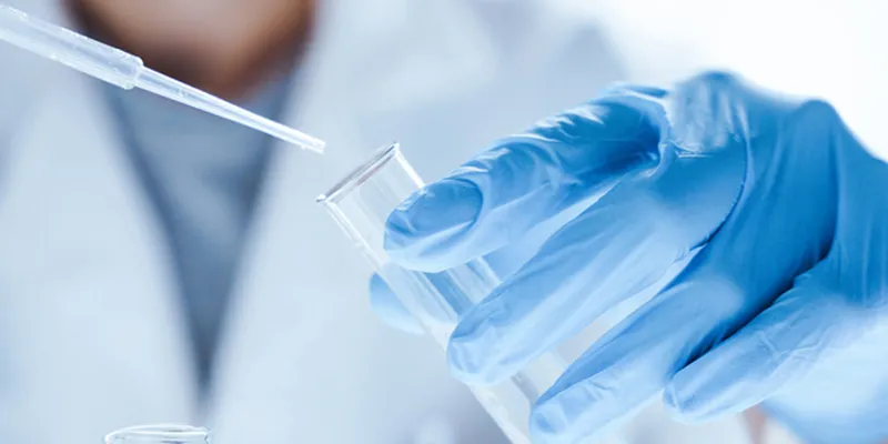 Microbiological research with a test tube and micropipette in hands of a laboratory worker in close-up
