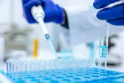A laboratory technician using a pipette to transfer liquid into test tubes.