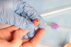 Close-up of a finger with a drop of blood for fingerstick proteomics.