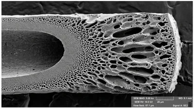 Scanning electron microscope image of hollow fiber membrane cross-section showing asymmetric pore structure with tight lumen surface skin layer and progressively larger pores toward the outer shell.