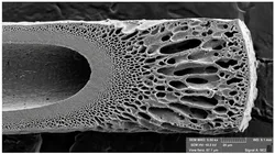 Scanning electron microscope image of hollow fiber membrane cross-section showing asymmetric pore structure with tight lumen surface skin layer and progressively larger pores toward the outer shell.