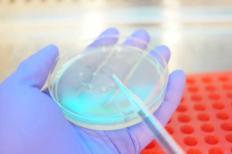 Hand holding a petri dish in a lab setting for microbiology testing