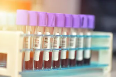 Collection of blood samples in test tubes for proteomics research