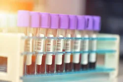 Collection of blood samples in test tubes for proteomics research