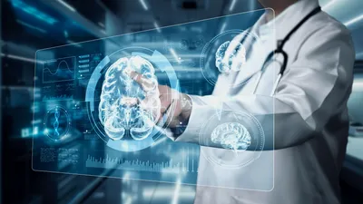 Visualizing brain imaging data related to Alzheimer's disease