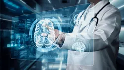 Visualizing brain imaging data related to Alzheimer's disease