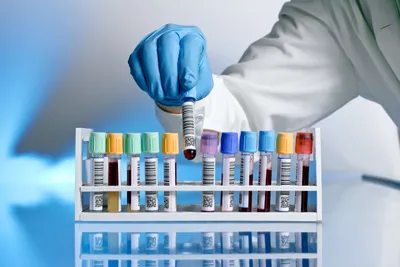 Laboratory technician handling blood samples for immune proteome profiling
