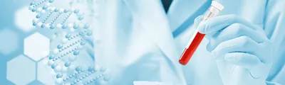 Scientist holding blood sample in lab