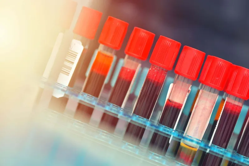 Clinical mass spectrometry samples in test tubes